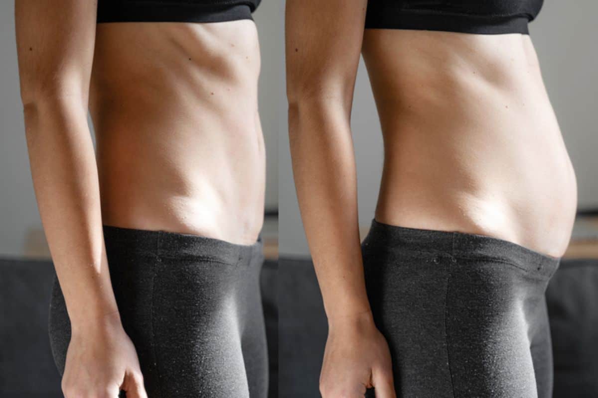 How long does diastasis recti take to improve Morden?