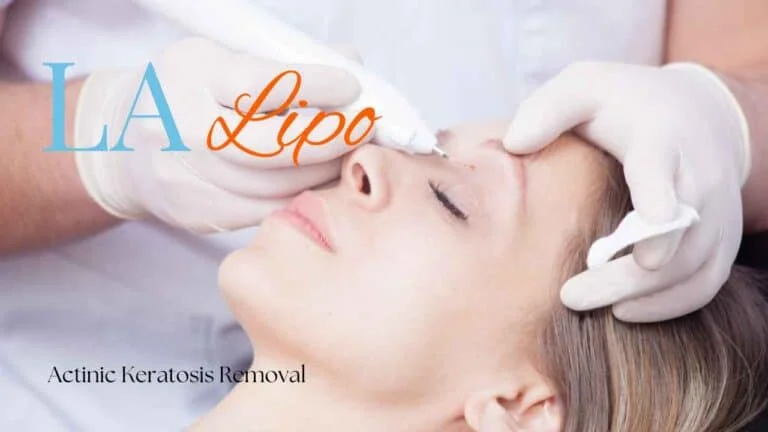 Woman receiving Actinic Keratosis Removal Treatment Morden