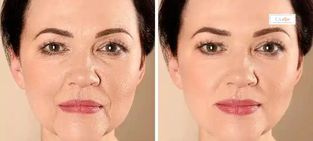 Why Aren’t My Skincare Products Making My Sagging Skin Look Firmer Morden?