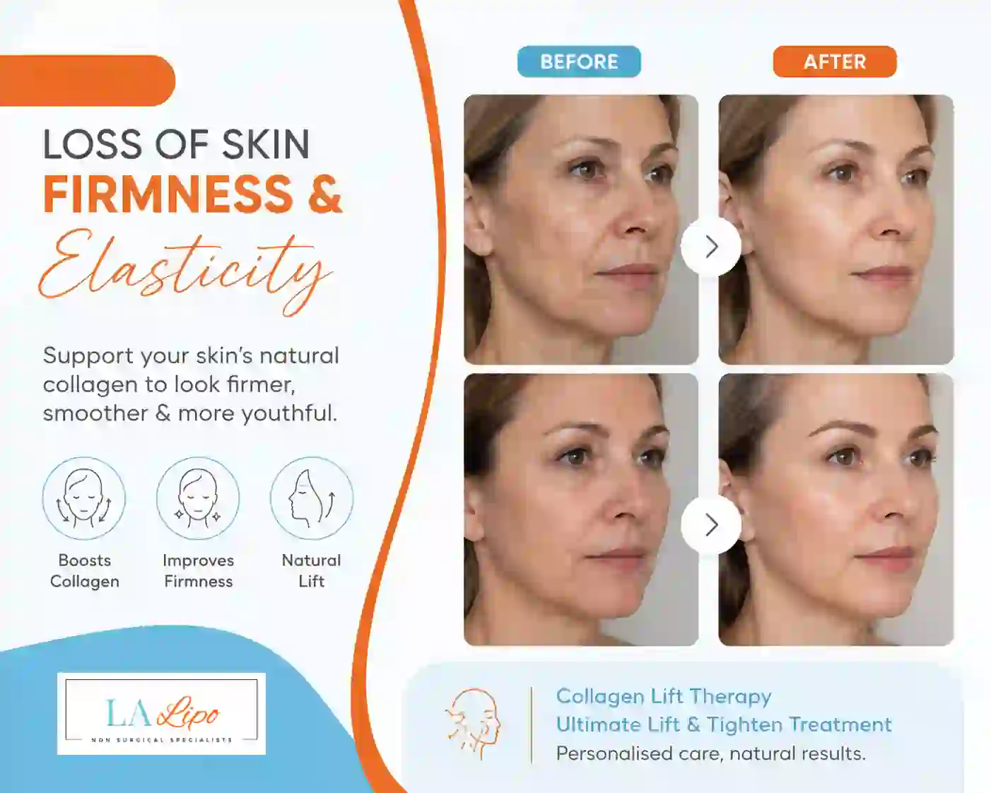 Sign #7: Loss of Skin Firmness and Elasticity Morden
