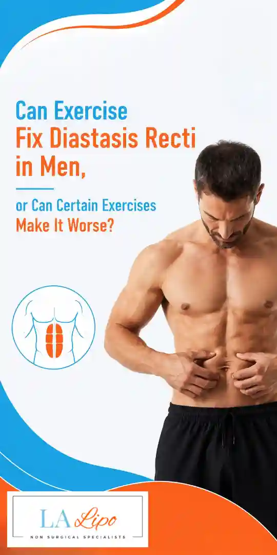 Can Exercise Fix Diastasis Recti in Men, or Can Certain Exercises Make It Worse Morden?