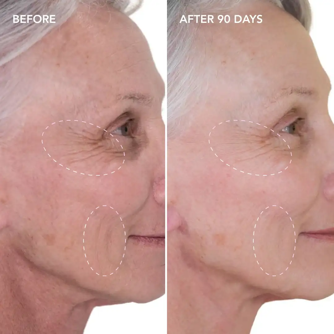 When will you see results Morden